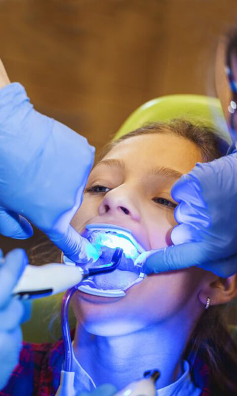 Young child receiving dental examination with blue light and gloved dentist hands in clinical setting.